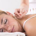 Horsham Back Pain Clinic - dry needling and acupuncture