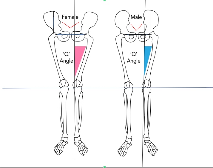 Difference in Q angle and pelvic shape in men and women